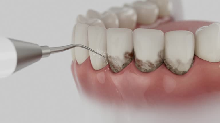 Reliable Emergency Dentist contractor in Mora, MN by Smile Center Dentistry